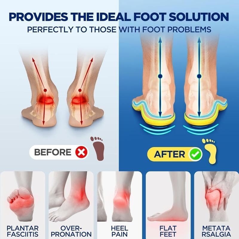 Magnetic Relief Insoles